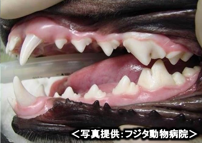 本来の歯は白く、歯肉はピンク色をしている