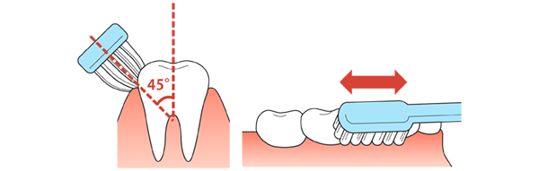 ハブラシの毛先を歯と歯ぐきの境目に45度の角度で当て、毛先が広がらない程度の軽い力で小刻みに（５～10mm程度）動かしてみがきます