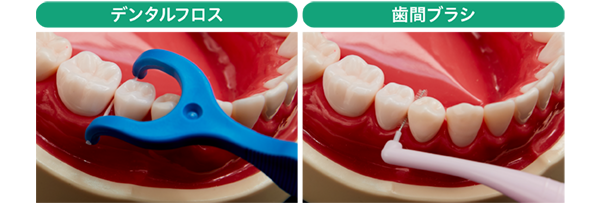 デンタルフロス　歯間ブラシ