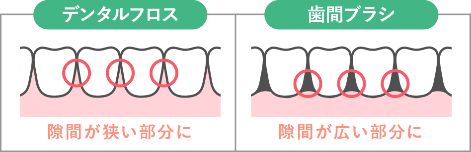 デンタルフロス　歯間ブラシ
