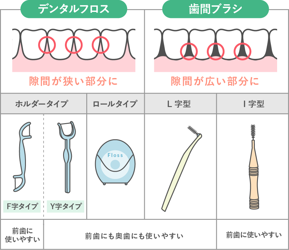 デンタルフロスと歯間ブラシの使い分け