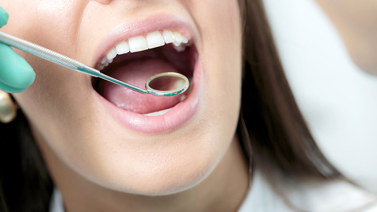 「歯周病」を引き起こす原因とは？ 歯周病の直接原因と間接原因