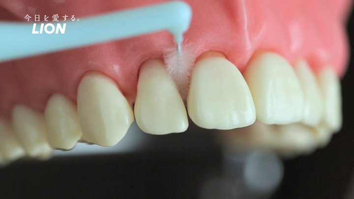 歯間ブラシは、歯間に無理なく挿入でき、使った際にきつく感じない程度を選ぶようにしましょう。