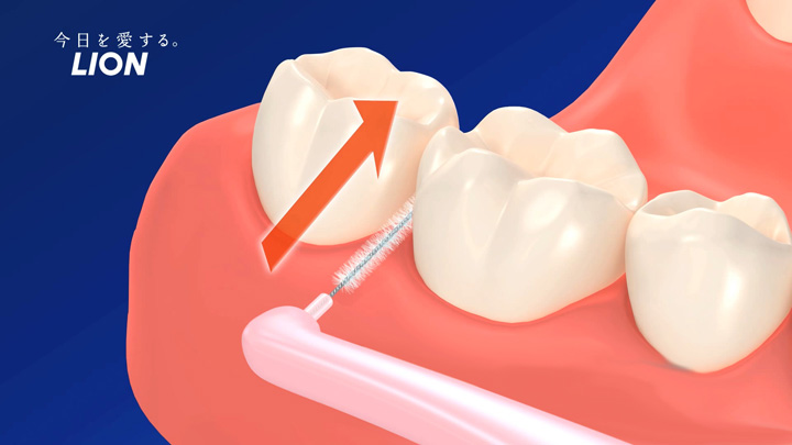 歯ぐきを傷付けないよう、歯間ブラシの先端を斜め上に向けるようにして挿入します。