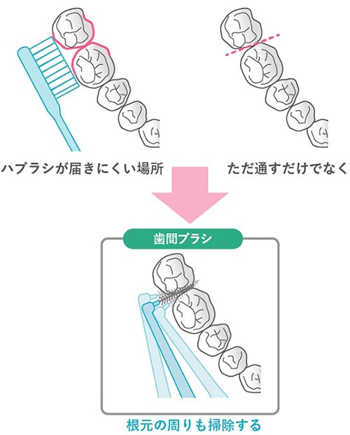 デンタルフロスと歯間ブラシ、どちらを使う？違いと種類、選び方をご紹介 | Lidea(リディア) by LION