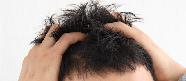 頭皮の硬さが「薄毛」のサイン!?今からでも遅くない薄毛対策