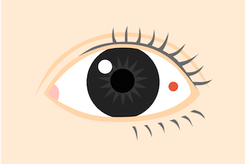 目が充血するのはなぜ ２種類の充血の 症状 と 原因 Lidea リディア By Lion