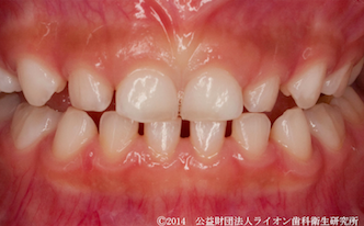 乳歯の生えかわり のしくみと年齢別 点検 のポイント Lidea リディア By Lion